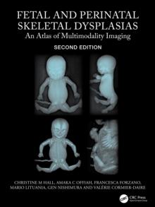 Fetal and Perinatal Skeletal Dysplasias : An Atlas of Multimodality Imaging