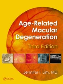 Age-Related Macular Degeneration