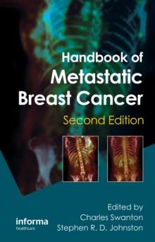 Handbook of Metastatic Breast Cancer