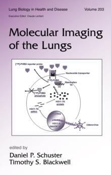 Molecular Imaging of the Lungs