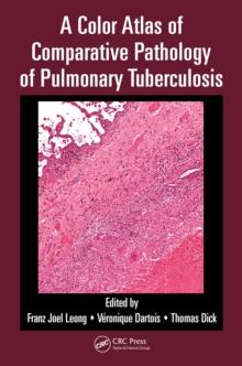 A Color Atlas of Comparative Pathology of Pulmonary Tuberculosis