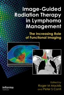 Image-Guided Radiation Therapy in Lymphoma Management : The Increasing Role of Functional Imaging