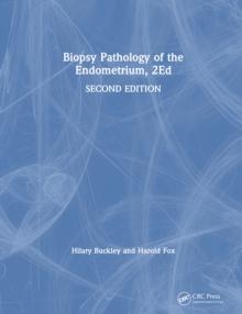 Biopsy Pathology of the Endometrium, 2Ed