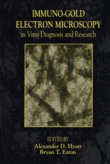 Immuno-Gold Electron Microscopy in Virus Diagnosis and Research