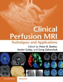 Clinical Perfusion MRI : Techniques and Applications