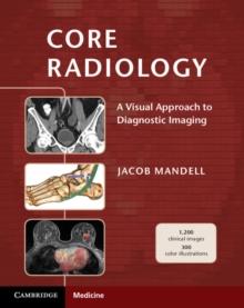 Core Radiology : A Visual Approach to Diagnostic Imaging