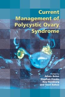 Current Management of Polycystic Ovary Syndrome