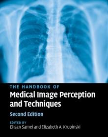 Handbook of Medical Image Perception and Techniques