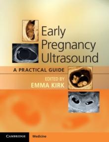 Early Pregnancy Ultrasound : A Practical Guide