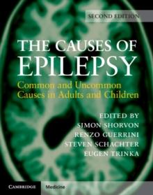 Causes of Epilepsy : Common and Uncommon Causes in Adults and Children