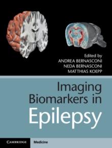 Imaging Biomarkers in Epilepsy