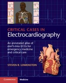 Critical Cases in Electrocardiography : An Annotated Atlas of Don't-Miss ECGs for Emergency Medicine and Critical Care