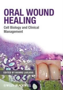 Oral Wound Healing : Cell Biology and Clinical Management