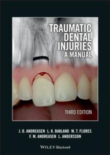 Traumatic Dental Injuries : A Manual