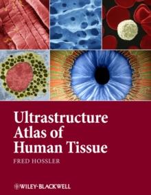 Ultrastructure Atlas of Human Tissues