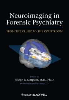 Neuroimaging in Forensic Psychiatry : From the Clinic to the Courtroom