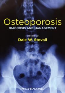 Osteoporosis : Diagnosis and Management