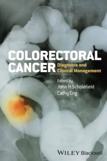 Colorectal Cancer : Diagnosis and Clinical Management