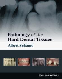 Pathology of the Hard Dental Tissues