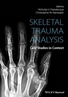 Skeletal Trauma Analysis : Case Studies in Context