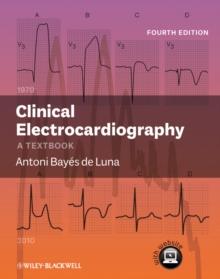 Clinical Electrocardiography : A Textbook