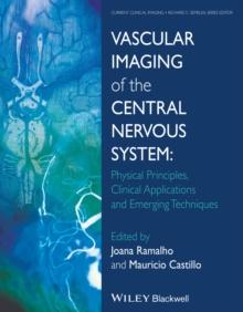 Vascular Imaging of the Central Nervous System : Physical Principles, Clinical Applications, and Emerging Techniques