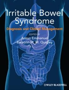 Irritable Bowel Syndrome : Diagnosis and Clinical Management