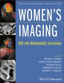 Women's Imaging : MRI with Multimodality Correlation