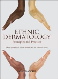 Ethnic Dermatology : Principles and Practice