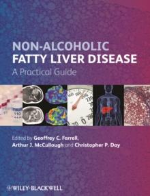 Non-Alcoholic Fatty Liver Disease : A Practical Guide