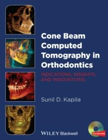 Cone Beam Computed Tomography in Orthodontics : Indications, Insights, and Innovations