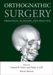 Orthognathic Surgery : Principles, Planning and Practice