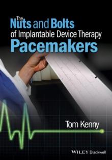 The Nuts and Bolts of Implantable Device Therapy : Pacemakers