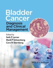 Bladder Cancer : Diagnosis and Clinical Management