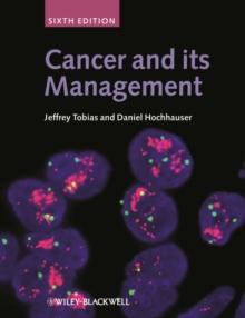 Cancer and its Management