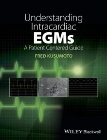 Understanding Intracardiac EGMs : A Patient Centered Guide