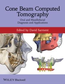 Cone Beam Computed Tomography : Oral and Maxillofacial Diagnosis and Applications