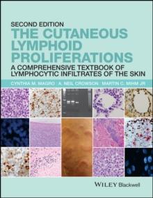 The Cutaneous Lymphoid Proliferations : A Comprehensive Textbook of Lymphocytic Infiltrates of the Skin