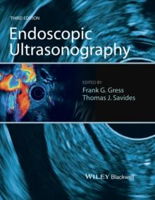 Endoscopic Ultrasonography