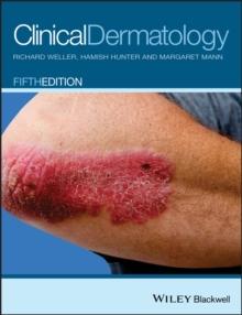 Clinical Dermatology