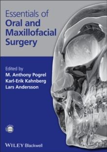 Essentials of Oral and Maxillofacial Surgery