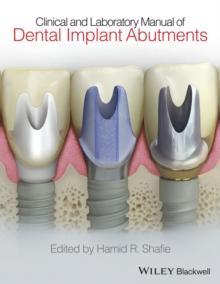 Clinical and Laboratory Manual of Dental Implant Abutments