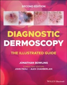 Diagnostic Dermoscopy : The Illustrated Guide