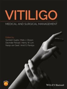 Vitiligo : Medical and Surgical Management