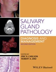 Salivary Gland Pathology : Diagnosis and Management