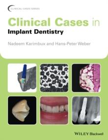 Clinical Cases in Implant Dentistry