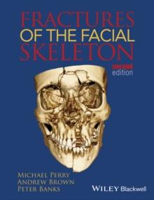 Fractures of the Facial Skeleton