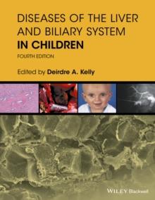 Diseases of the Liver and Biliary System in Children