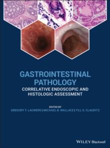 Gastrointestinal Pathology : Correlative Endoscopic and Histologic Assessment