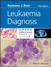 Leukaemia Diagnosis